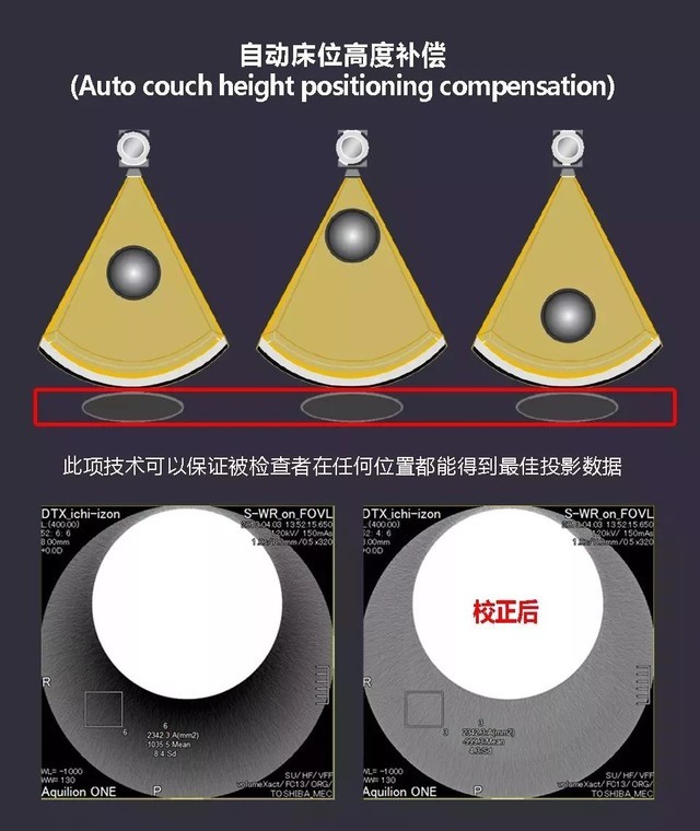 佳能肺部CT影像 快速排查新冠病毒肺炎